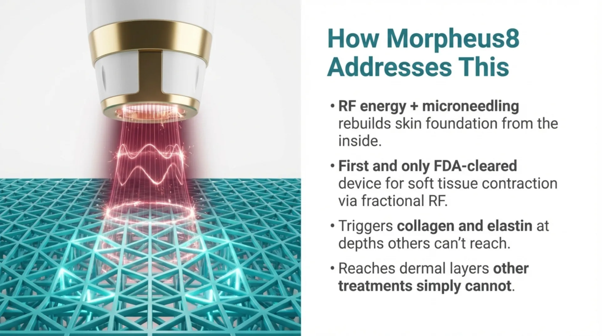Morpheus8 Protocol Guide — slide 3 of 12
